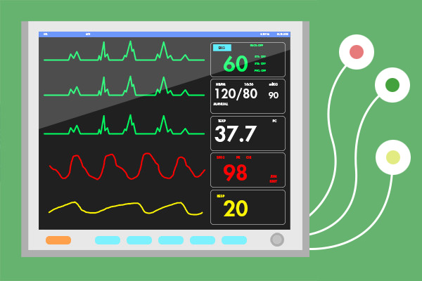 EKG